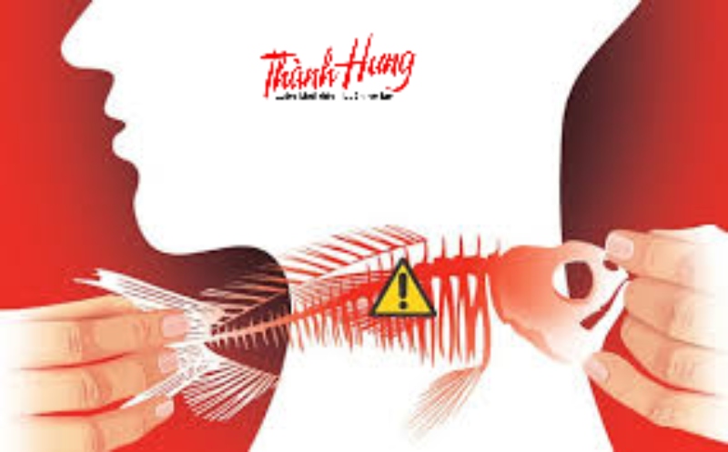 Dấu hiệu nhận biết khi bạn bị hóc xương cá.